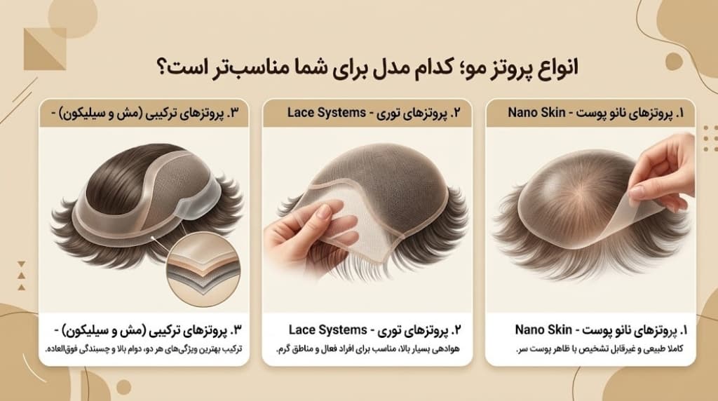 انواع پروتز مو؛ کدام مدل برای شما مناسبتر است؟